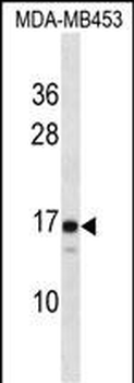 LIM2 Antibody (C-term)