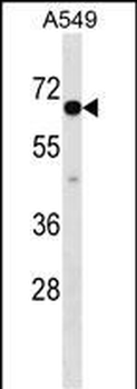 CLPTM1L Antibody (C-term)