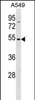 TM6SF1 Antibody (N-term)