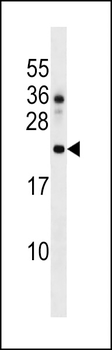 DNAJC24 Antibody (Center)