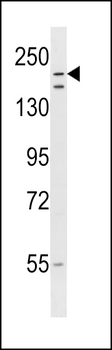 RNF160 Antibody (Center)