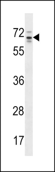 RP13-102H20.1/ARHGAP36 Antibody (C-term)