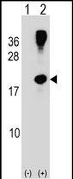 RHOG Antibody (C-term)