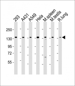 SF3B2 Antibody (Center)