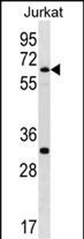 SMARCD1 Antibody (C-term)