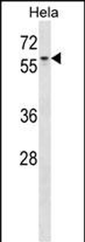AGFG1 Antibody (N-term)