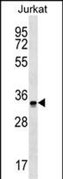 OR2G6 Antibody (N-term)