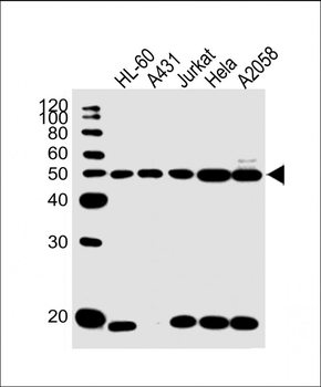 KRT28 Antibody (C-term)