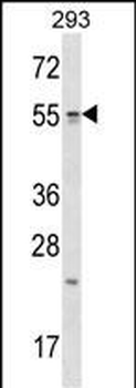 TTC23 Antibody (Center)