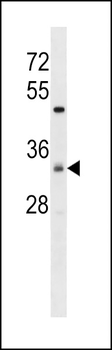 ZDHC7 Antibody (C-term)