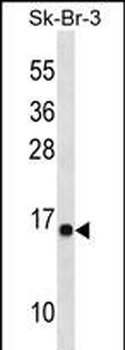 PRR34 Antibody (C-term)