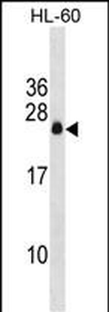 APRG1 Antibody (Center)