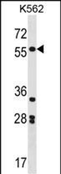 SOX11 Antibody (N-term)