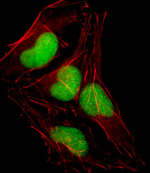SOX18 Antibody (N-term)
