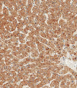 ASGR1 Antibody (N-term)
