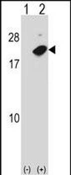 NUDT2 Antibody (Center)