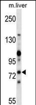 Mouse Zap70 Antibody (C-term)