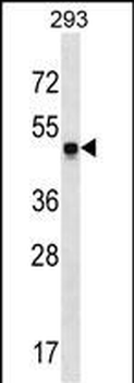SNX17 Antibody (N-term)