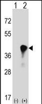 C4BPB Antibody (Center)