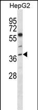 NEIL2 Antibody (N-term)