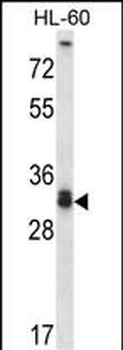 STX6 Antibody (Center)
