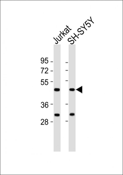 ZIC1 Antibody (N-term)