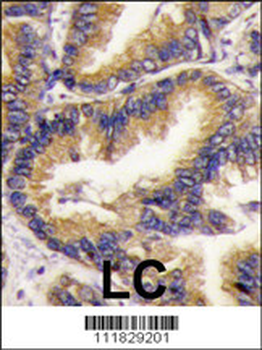 URM1 Antibody (N-term)