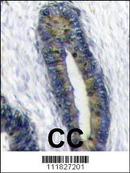 FAU Antibody (Center)