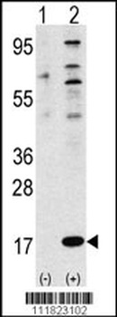 FAU Antibody (N-term)