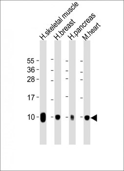 COX7A1 Antibody (Center)