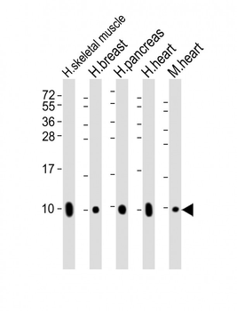 COX7A1 Antibody (Center)