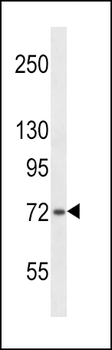 SH2B1 Antibody (C-term)