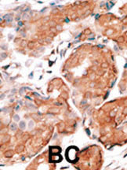 GCAP1 Antibody (C-term)