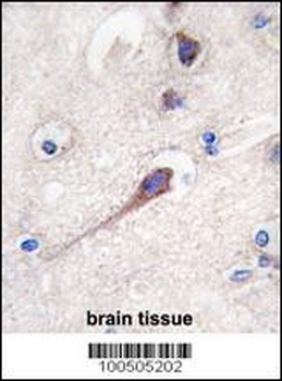 Hippocalcin Antibody (N-term)