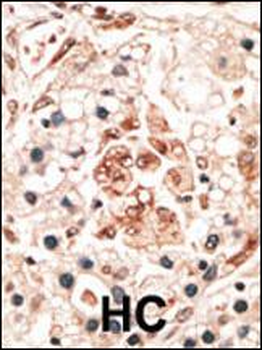 Hippocalcin Antibody (N-term)