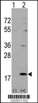 VILIP3 Antibody (N-term)