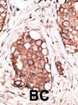 VILIP3 Antibody (N-term)