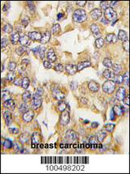 VILIP1 Antibody (C-term)