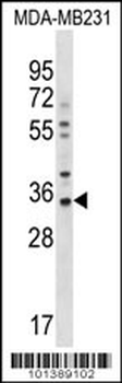 GJB5 Antibody (Center)
