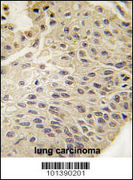 GJB5 Antibody (Center)