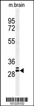 GJB2 Antibody (C-term)