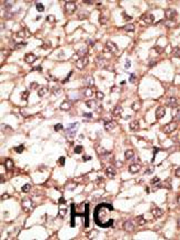 Kremen Antibody (N-term)