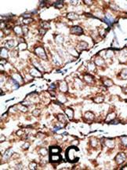 DKKL1 Antibody (C-term)