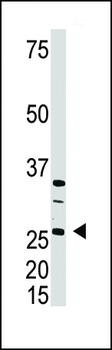 DKK4 Antibody (C-term)