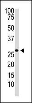 DKK2 Antibody (N-term)