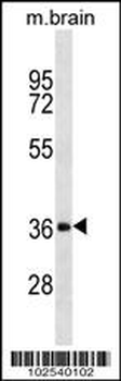 DKK2 Antibody (N-term)