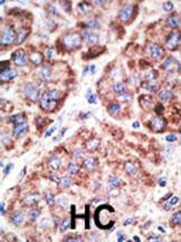 Mouse TLR6 Antibody (N-term)
