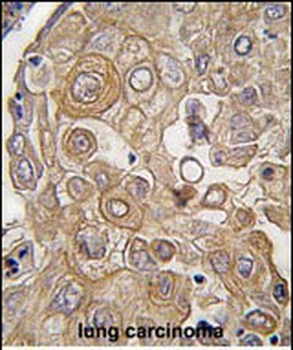 TLR6 Antibody (C-term)