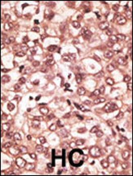 TLR6 Antibody (C-term)