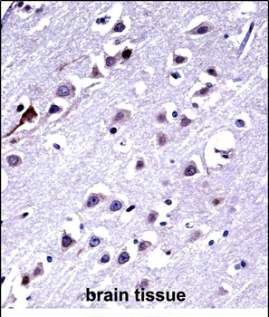 KIF16b Antibody